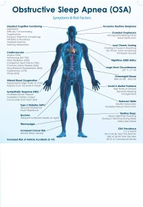 Sleep Apnea Chart